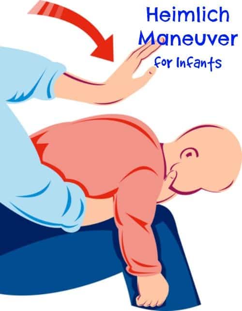 Heimlich Maneuver on Infants