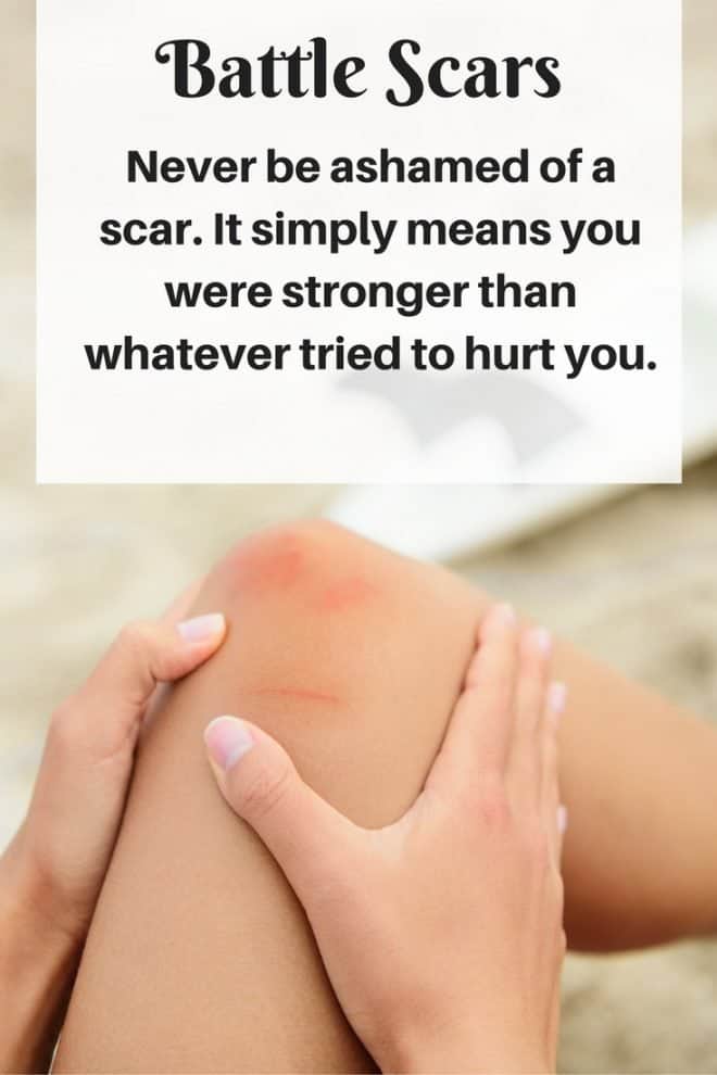 Battle Scars - Do you have any? I'm sharing some of my battle scars including bruised ego and scars of the heart.