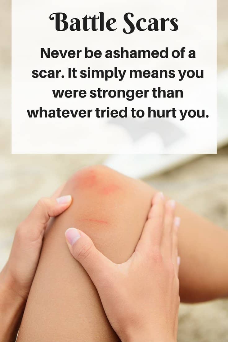 Battle Scars - What Doesn't Kill You Makes You Stronger - An Alli Event